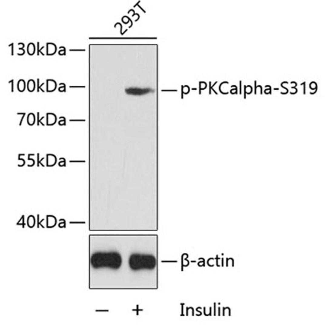 Western blot - Phospho-PKCalpha-S319 antibody (AP0560)