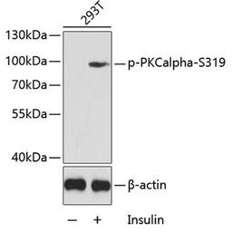 Western blot - Phospho-PKCalpha-S319 antibody (AP0560)