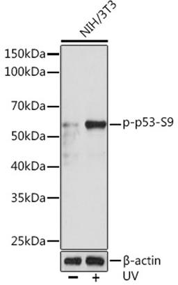 Western blot - Phospho-p53-S9 Rabbit mAb (AP0985)