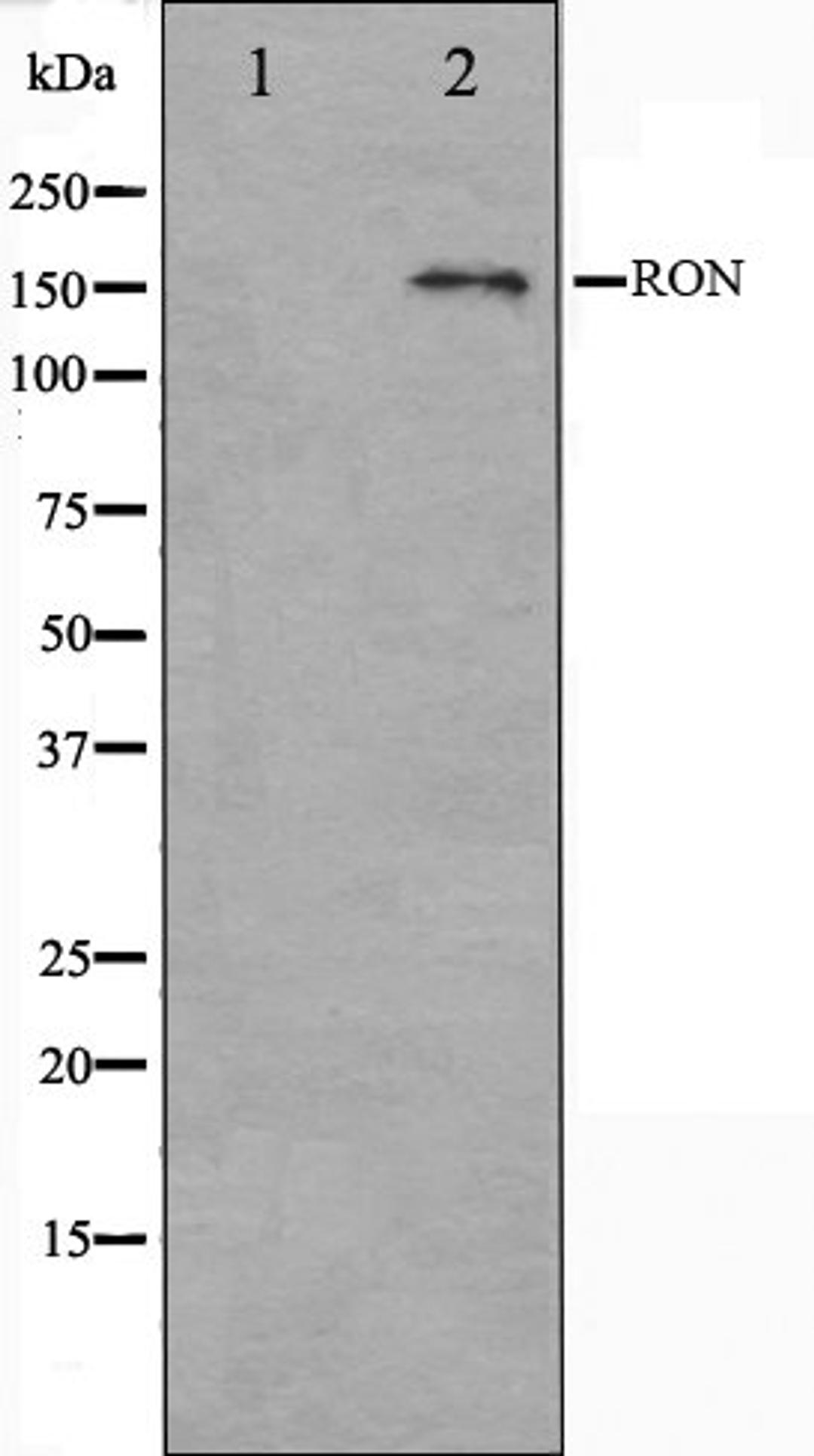 Western blot analysis of HeLa cell lysate using RON antibody