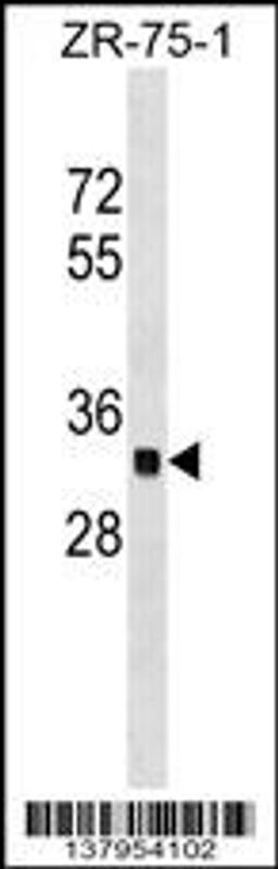 Western blot analysis in ZR-75-1 cell line lysates (35ug/lane).