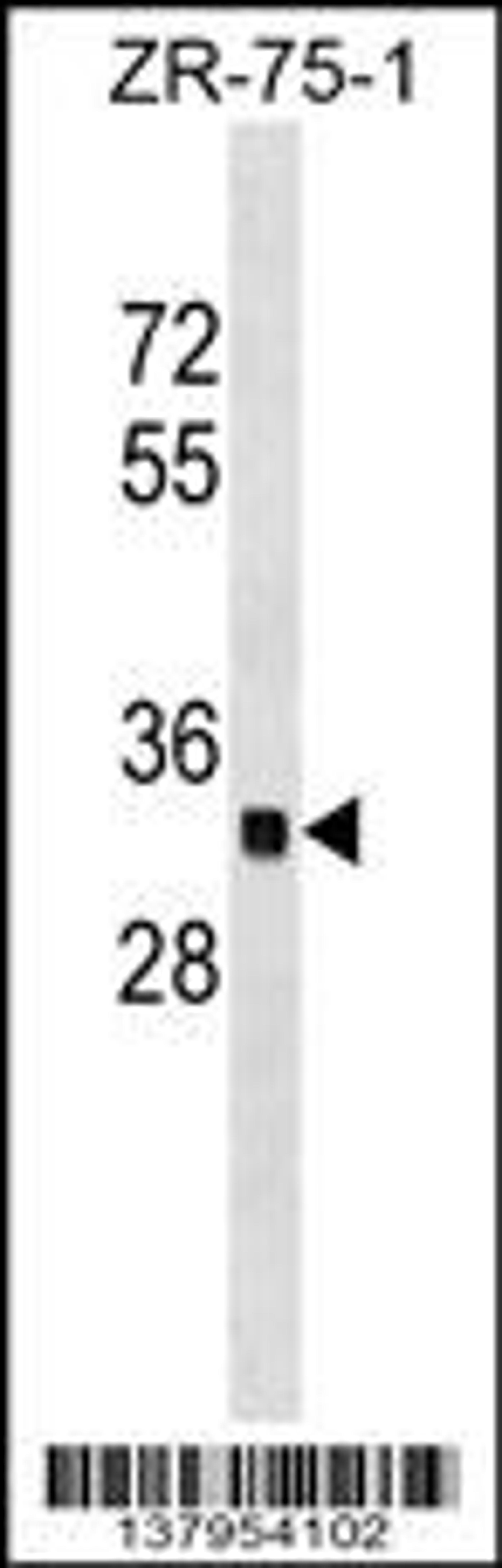 Western blot analysis in ZR-75-1 cell line lysates (35ug/lane).