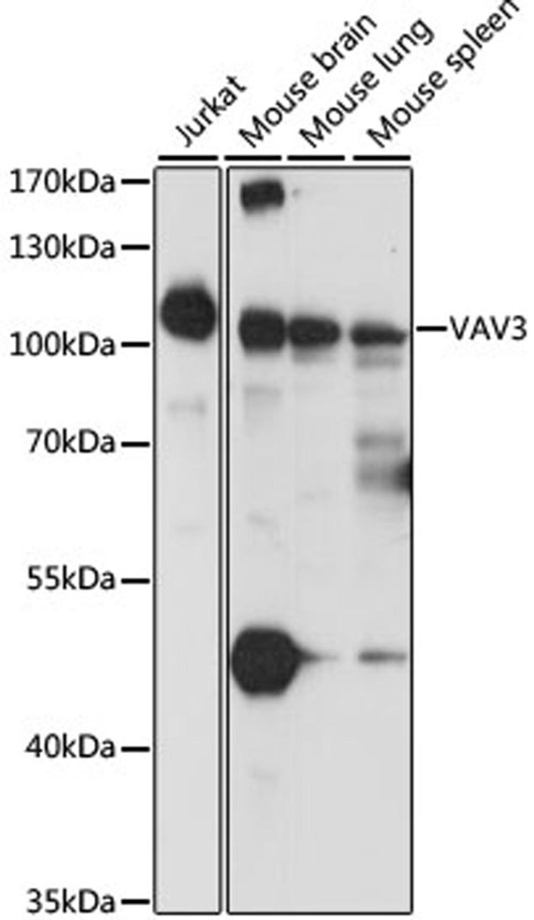 Western blot - VAV3 antibody (A15385)