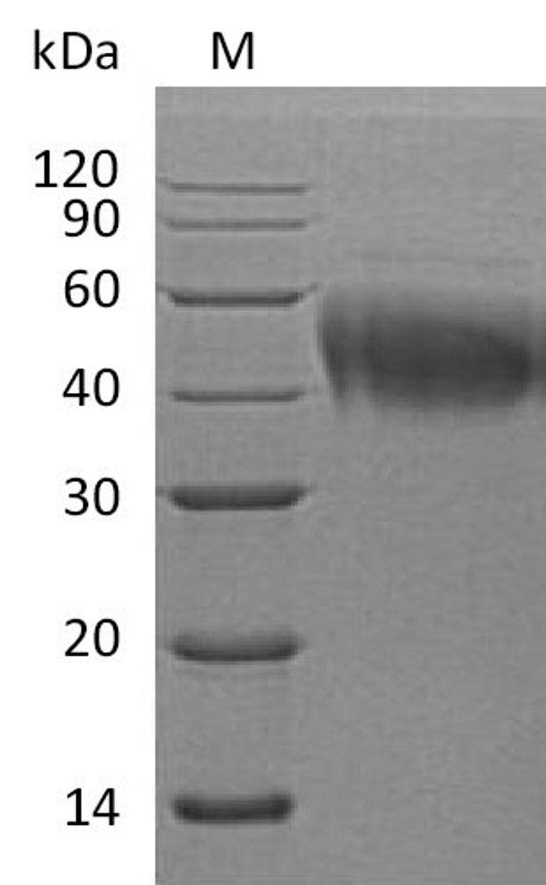 (Tris-Glycine gel) Discontinuous SDS-PAGE (reduced) with 5% enrichment gel and 15% separation gel.