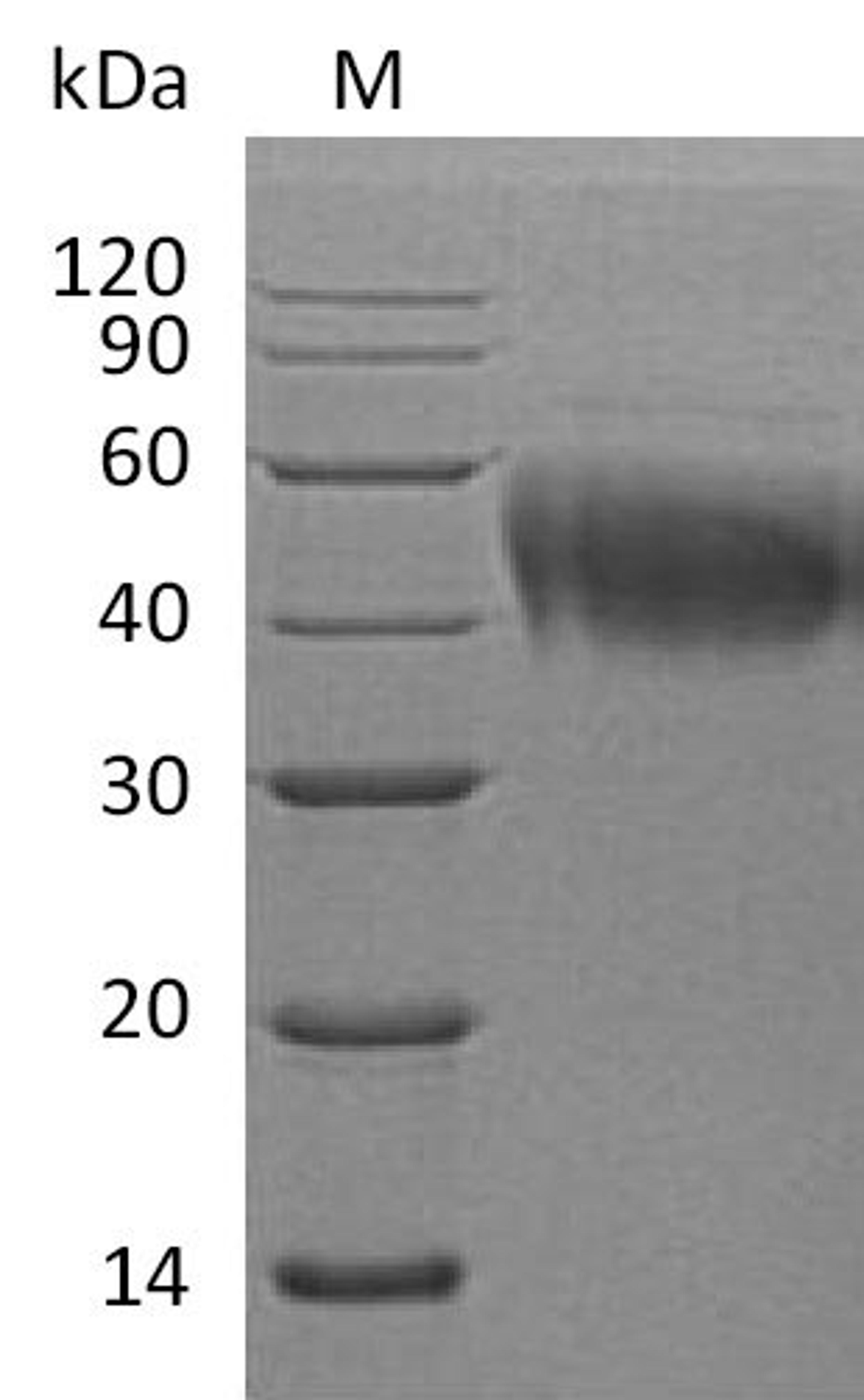 (Tris-Glycine gel) Discontinuous SDS-PAGE (reduced) with 5% enrichment gel and 15% separation gel.