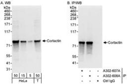 Detection of human Cortactin by western blot and immunoprecipitation.