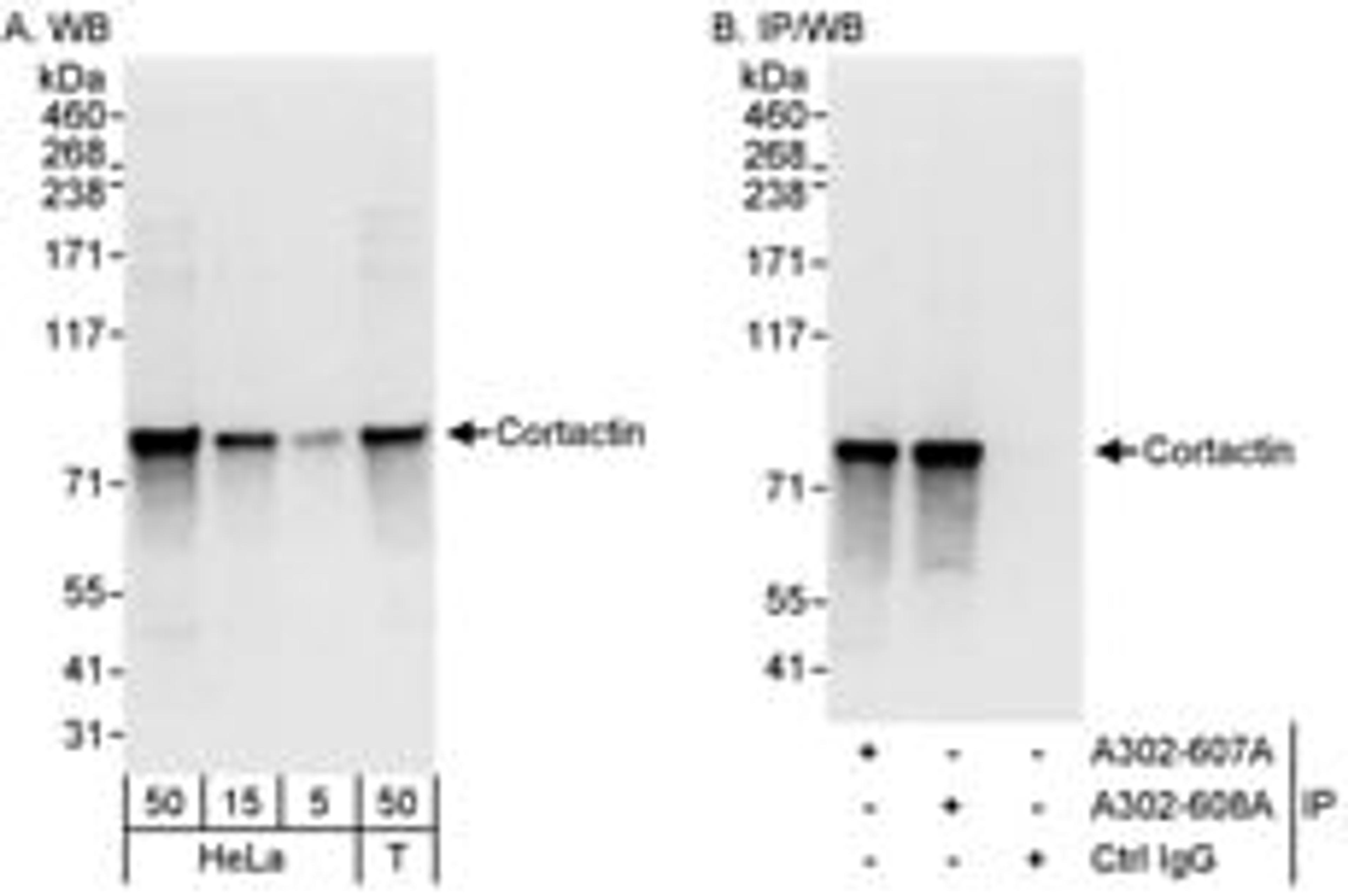 Detection of human Cortactin by western blot and immunoprecipitation.