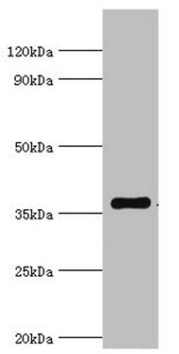 Western blot. All lanes: WDR5 antibody at 2µg/ml + A431 whole cell lysate. Secondary. Goat polyclonal to rabbit IgG at 1/10000 dilution. Predicted band size: 37 kDa. Observed band size: 37 kDa