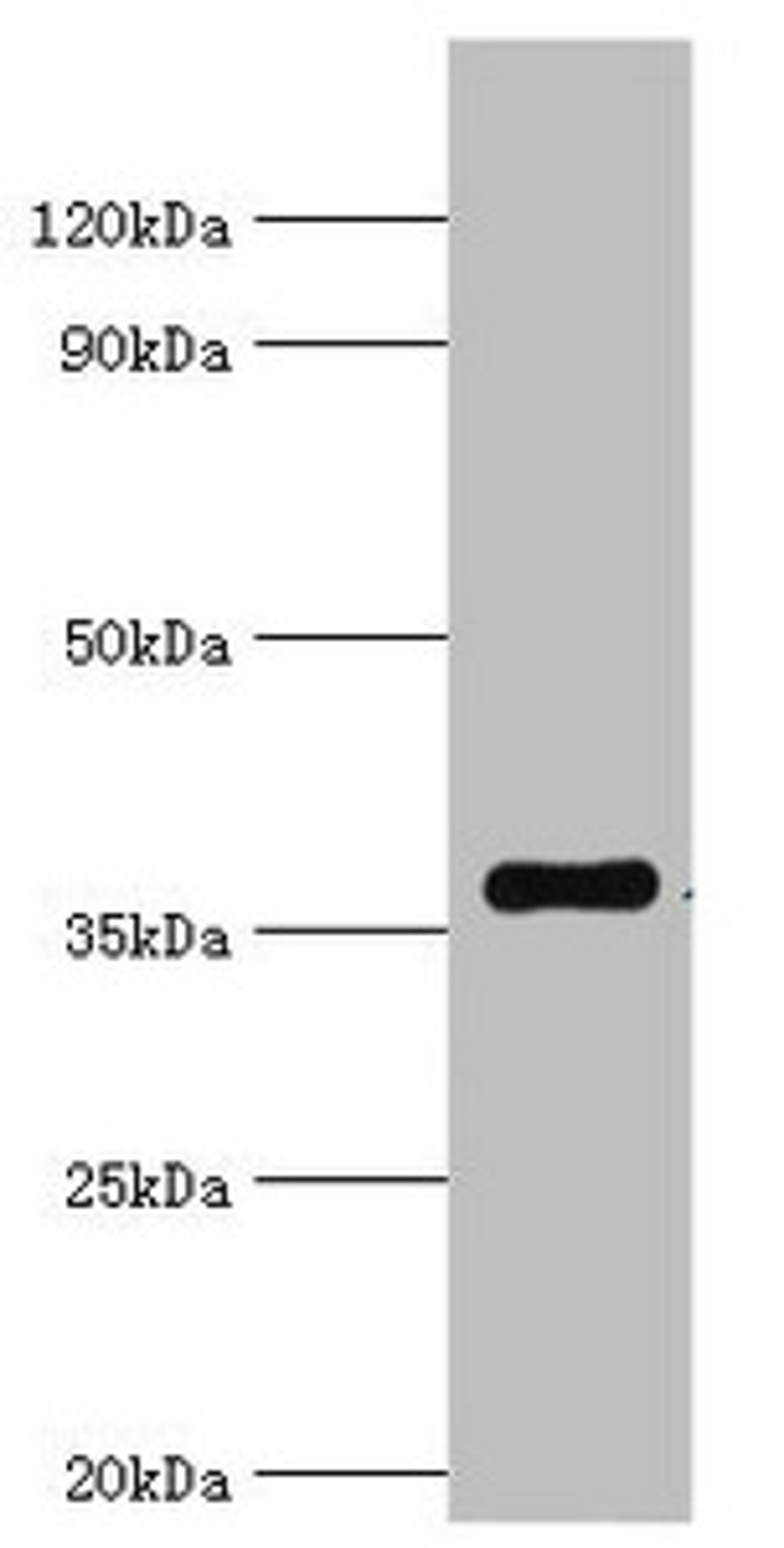 Western blot. All lanes: WDR5 antibody at 2µg/ml + A431 whole cell lysate. Secondary. Goat polyclonal to rabbit IgG at 1/10000 dilution. Predicted band size: 37 kDa. Observed band size: 37 kDa
