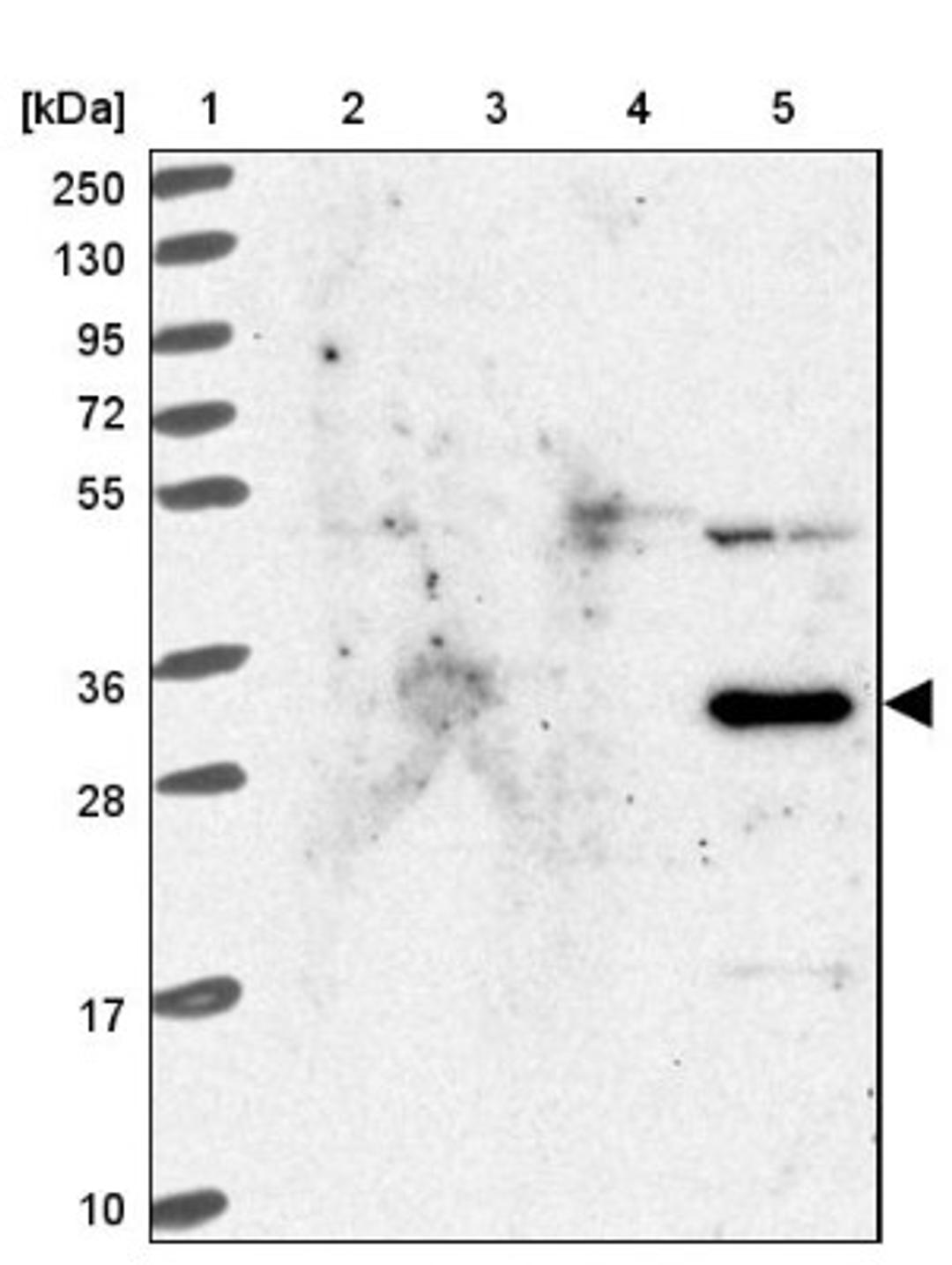 Western Blot: SLC35B4 Antibody [NBP2-13329] - Lane 1: Marker [kDa] 250, 130, 95, 72, 55, 36, 28, 17, 10<br/>Lane 2: Human cell line RT-4<br/>Lane 3: Human cell line U-251MG sp<br/>Lane 4: Human plasma (IgG/HSA depleted)<br/>Lane 5: Human liver tissue