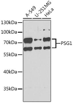 Western blot - PSG1 antibody (A6399)