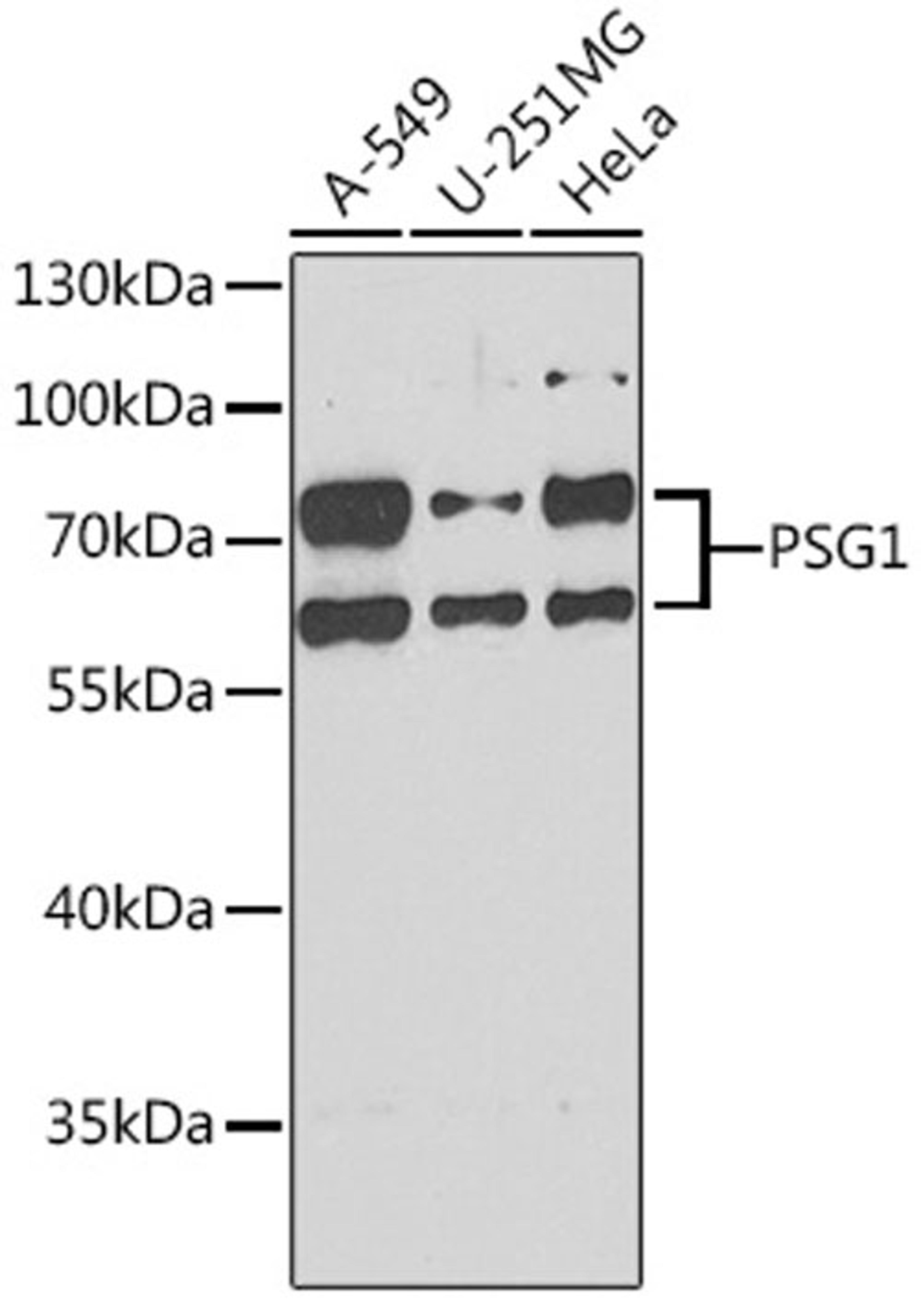 Western blot - PSG1 antibody (A6399)