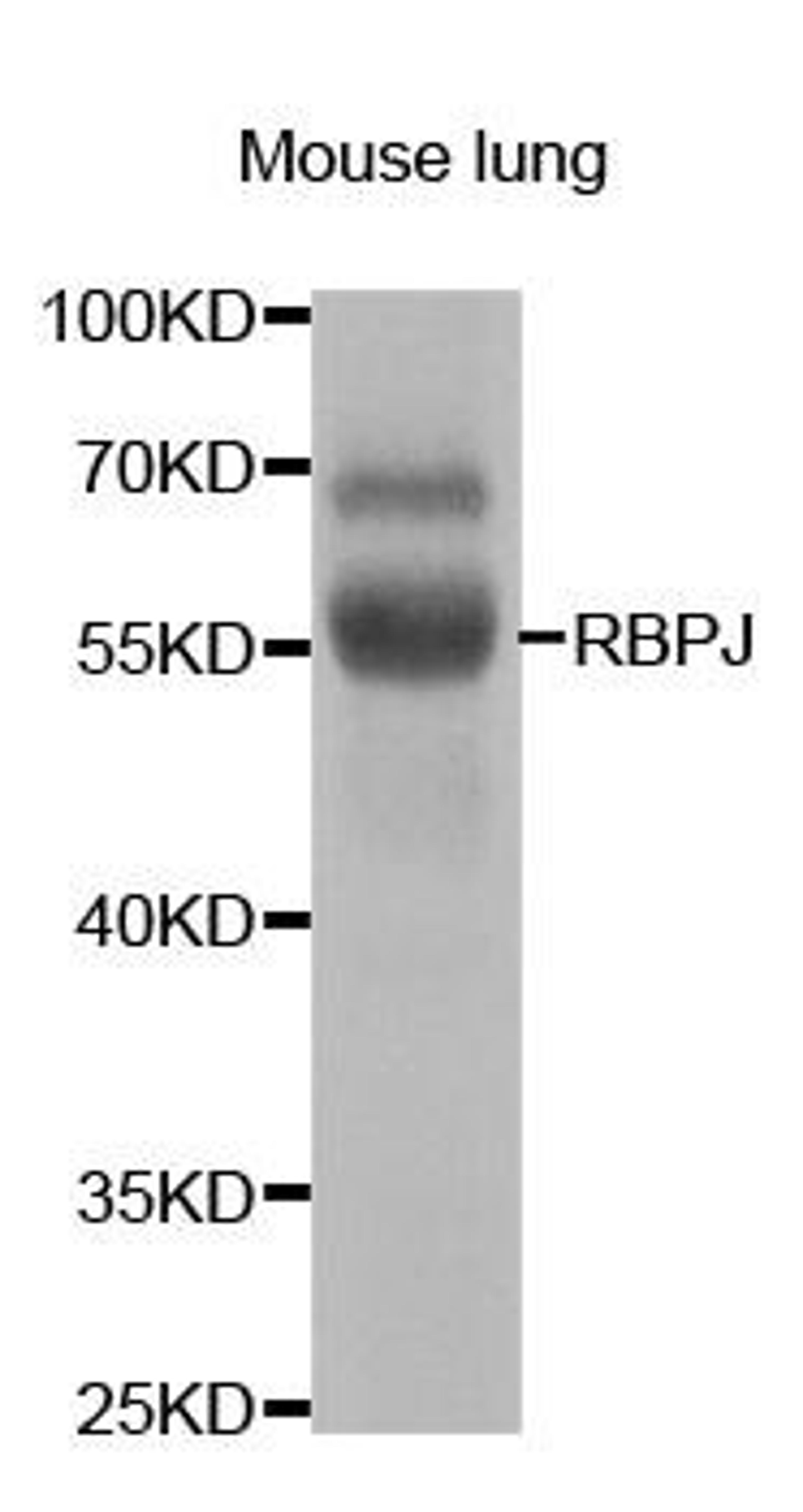 Western blot analysis of extracts of mouse lung using RBPJ antibody