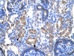 Antibody used in IHC on Human kidney at 4.0-8.0.