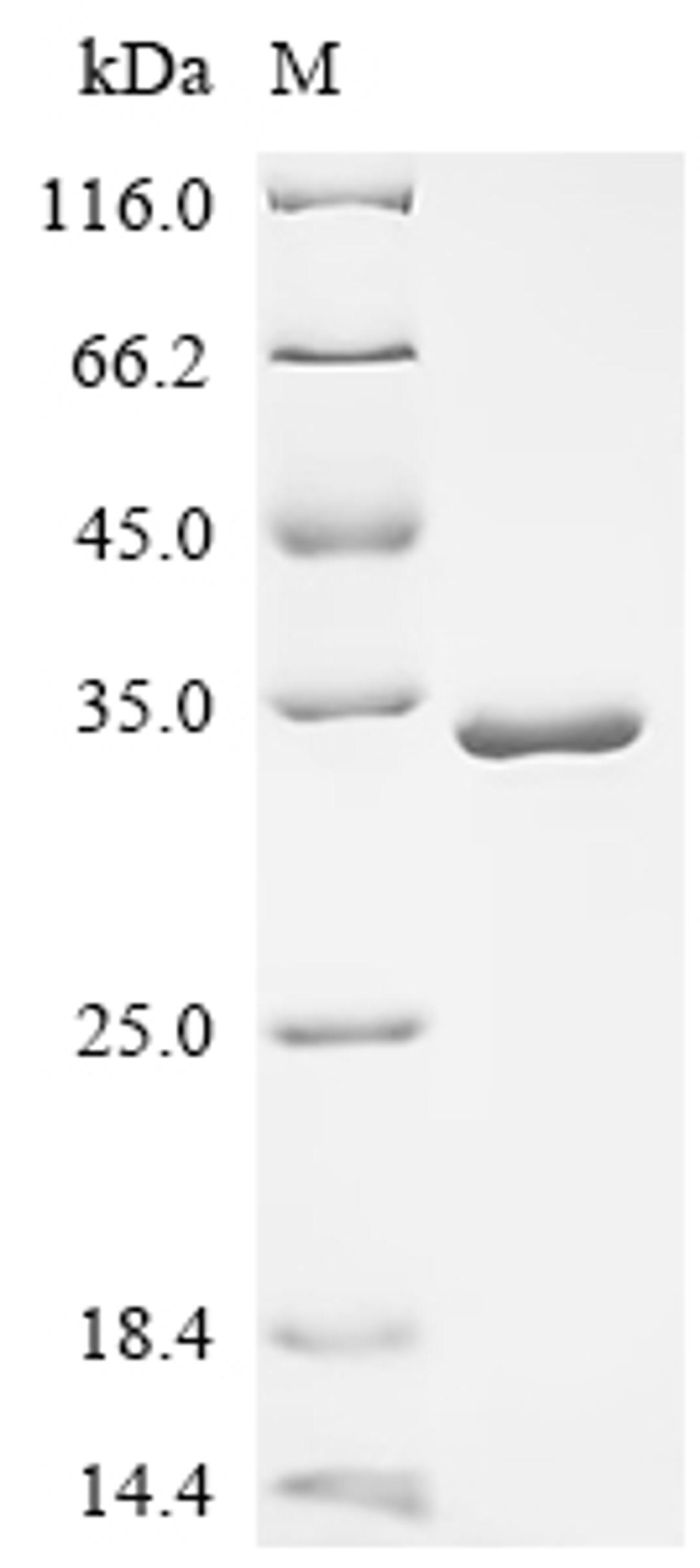 (Tris-Glycine gel) Discontinuous SDS-PAGE (reduced) with 5% enrichment gel and 15% separation gel.