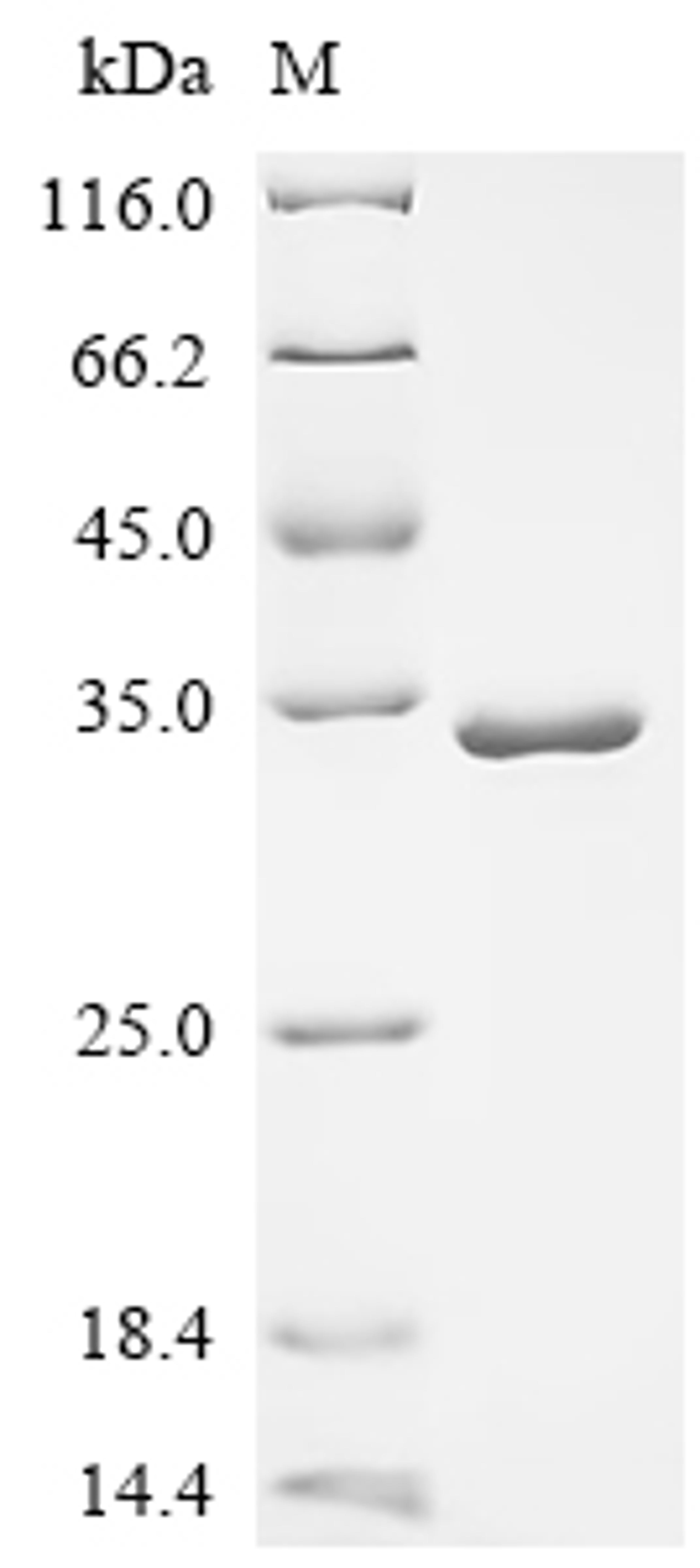 (Tris-Glycine gel) Discontinuous SDS-PAGE (reduced) with 5% enrichment gel and 15% separation gel.