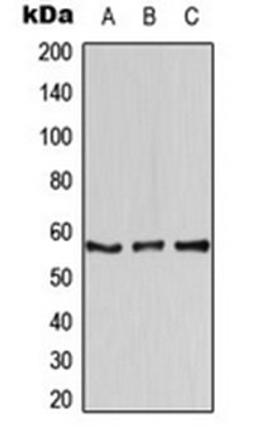 Western blot analysis of Jurkat (Lane 1), mouse lung (Lane 2), rat lung (Lane 3) whole cell lysates using AIRE antibody