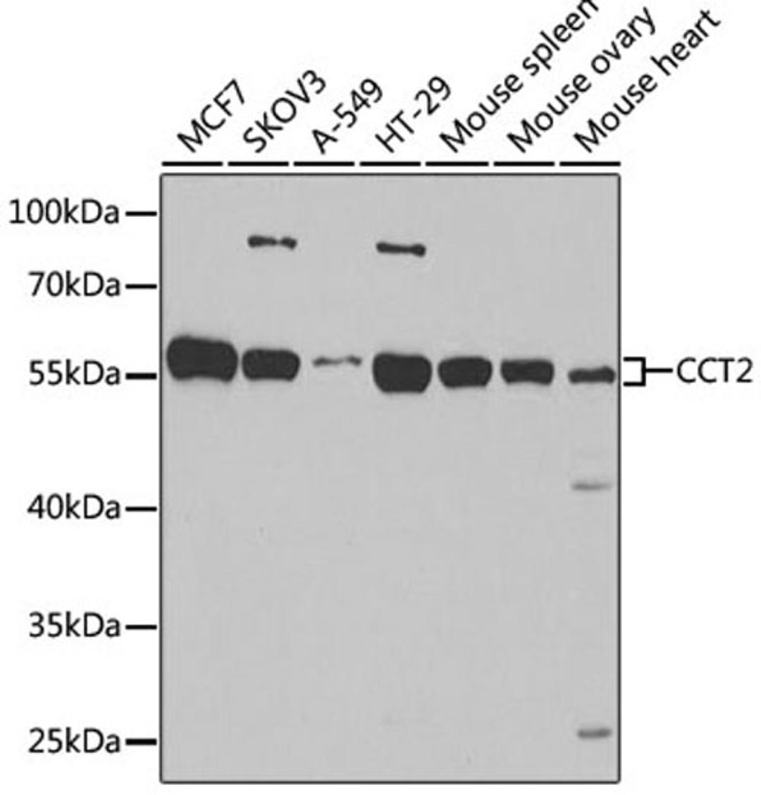 Western blot - CCT2 antibody (A6546)