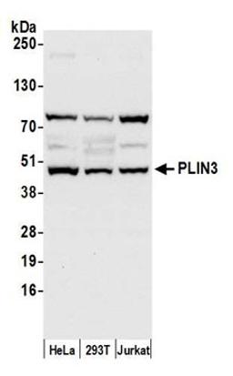 Detection of human PLIN3 by western blot.