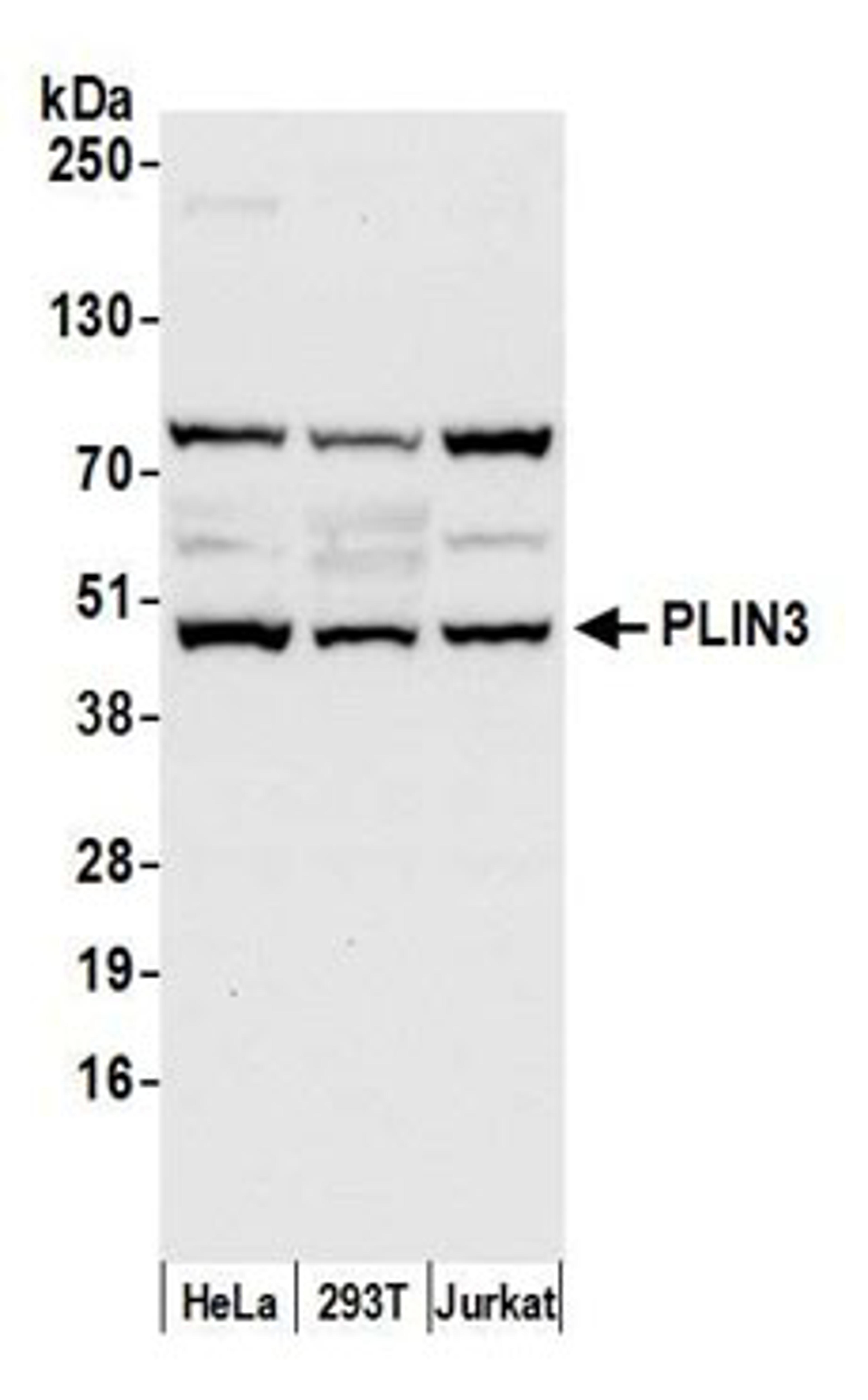 Detection of human PLIN3 by western blot.