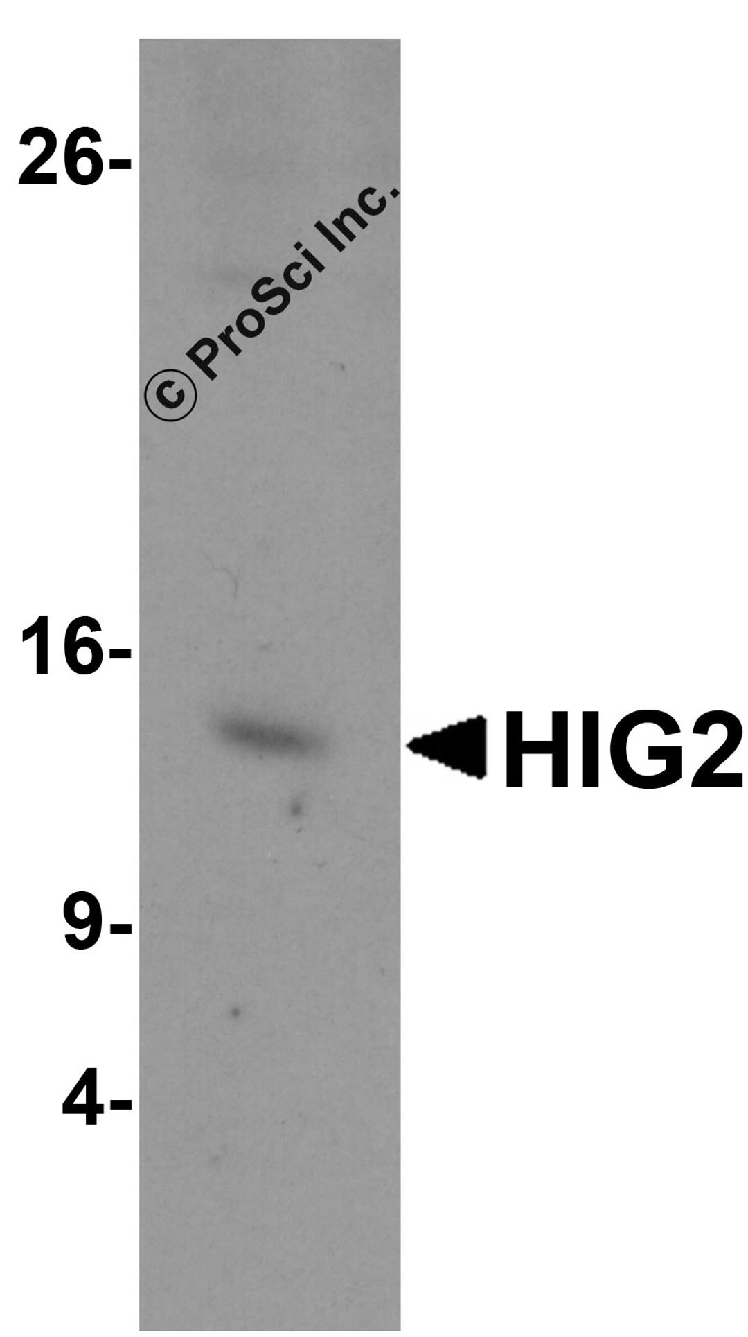 Western blot analysis of HIG2 in A549 cell lysate with HIG2 antibody at 1 μg/mL.