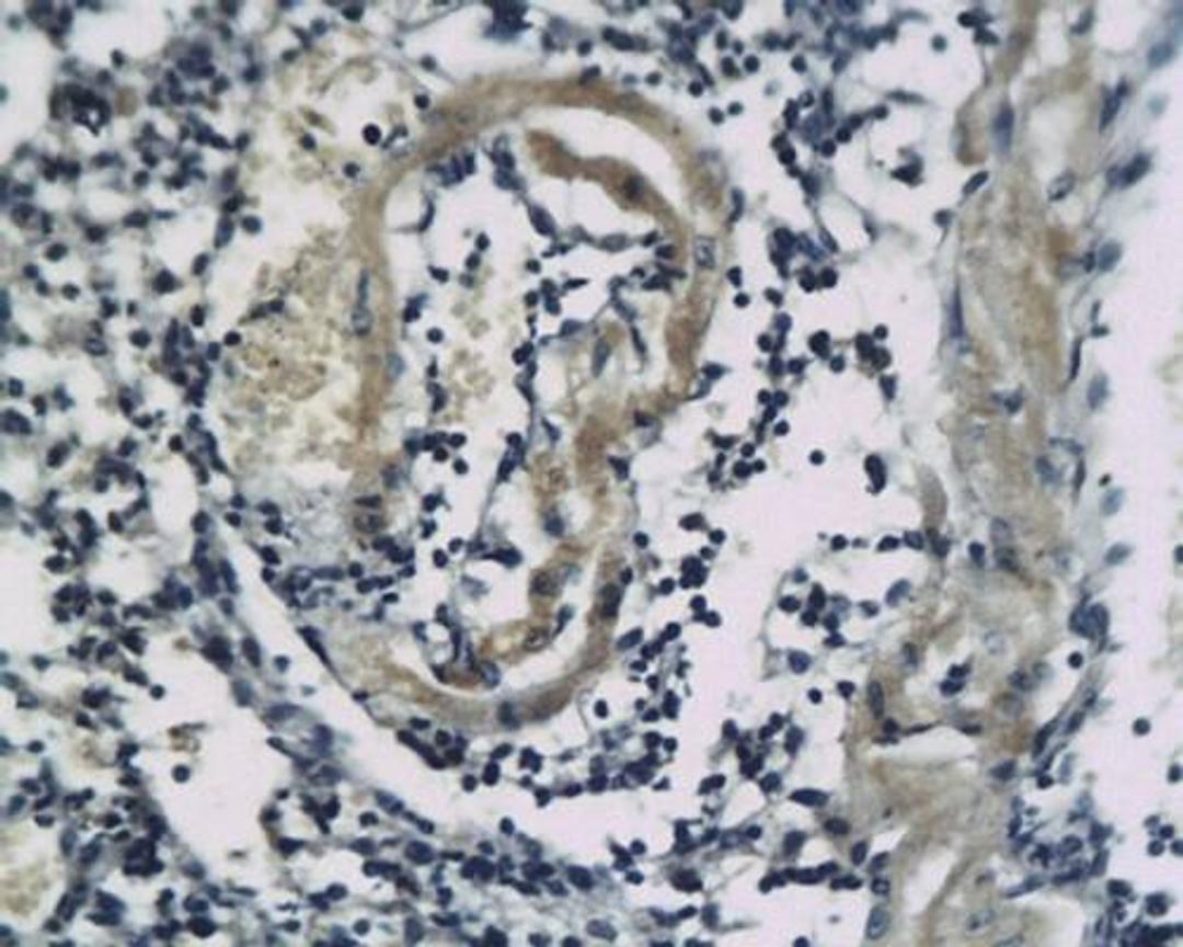 Immunohistochemical analysis of paraffin-embedded mice lung tissue using SSTR2 antibody