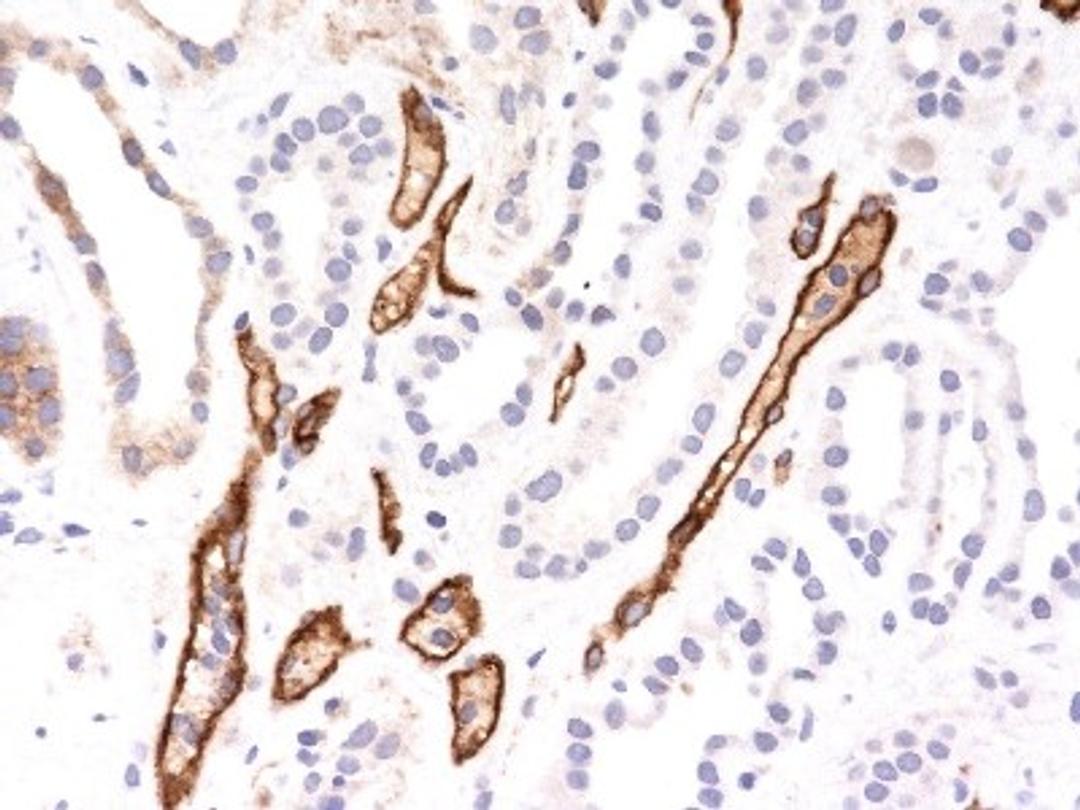 Immunohistochemistry-Paraffin: Complement C4d Antibody (C4D204) [NBP2-34234] - Formalin-fixed, paraffin-embedded human kidney transplant tissue (40X) stained with Complement 4d Ab (C4D204).