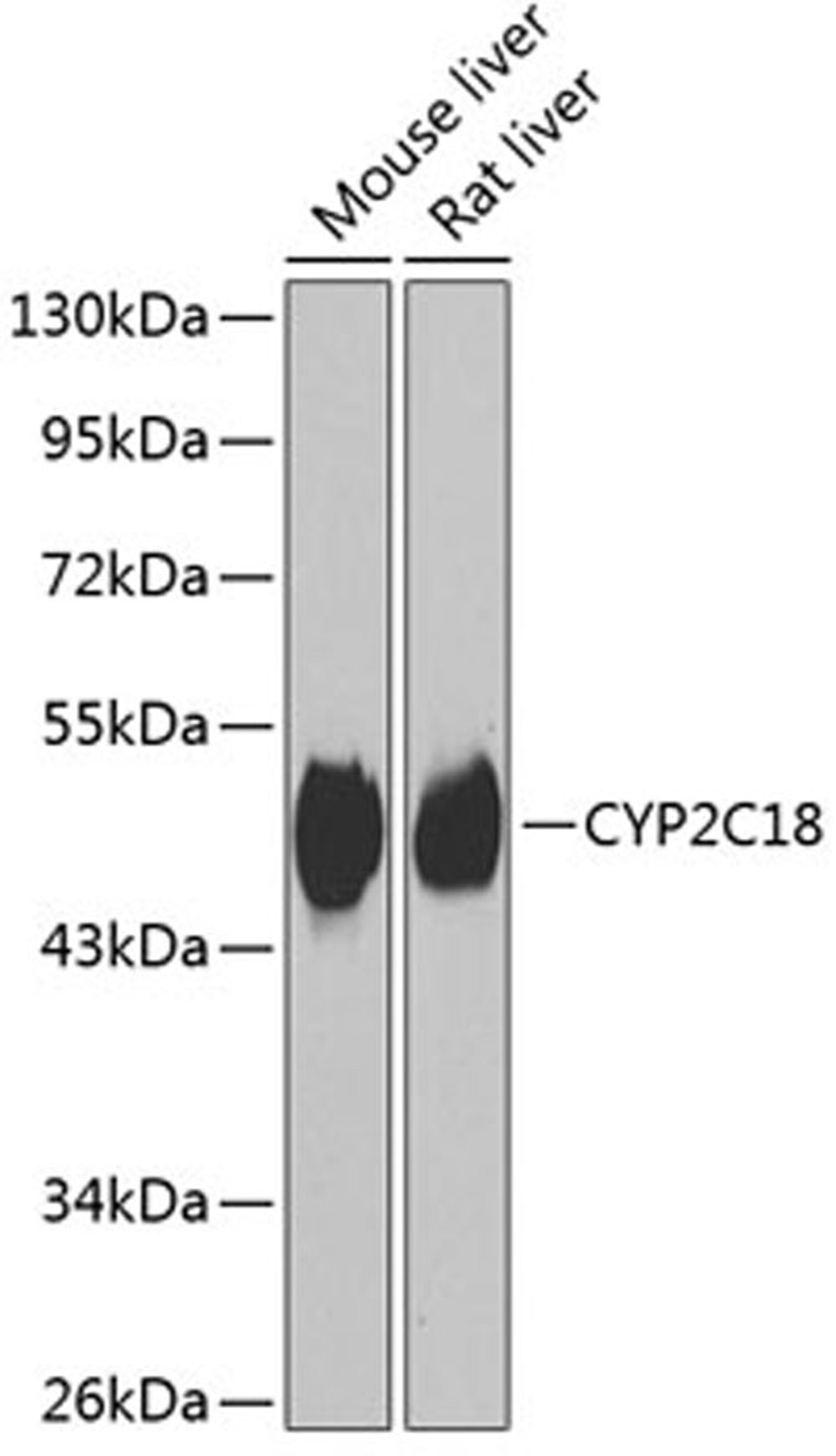 Western blot - CYP2C18 antibody (A7431)