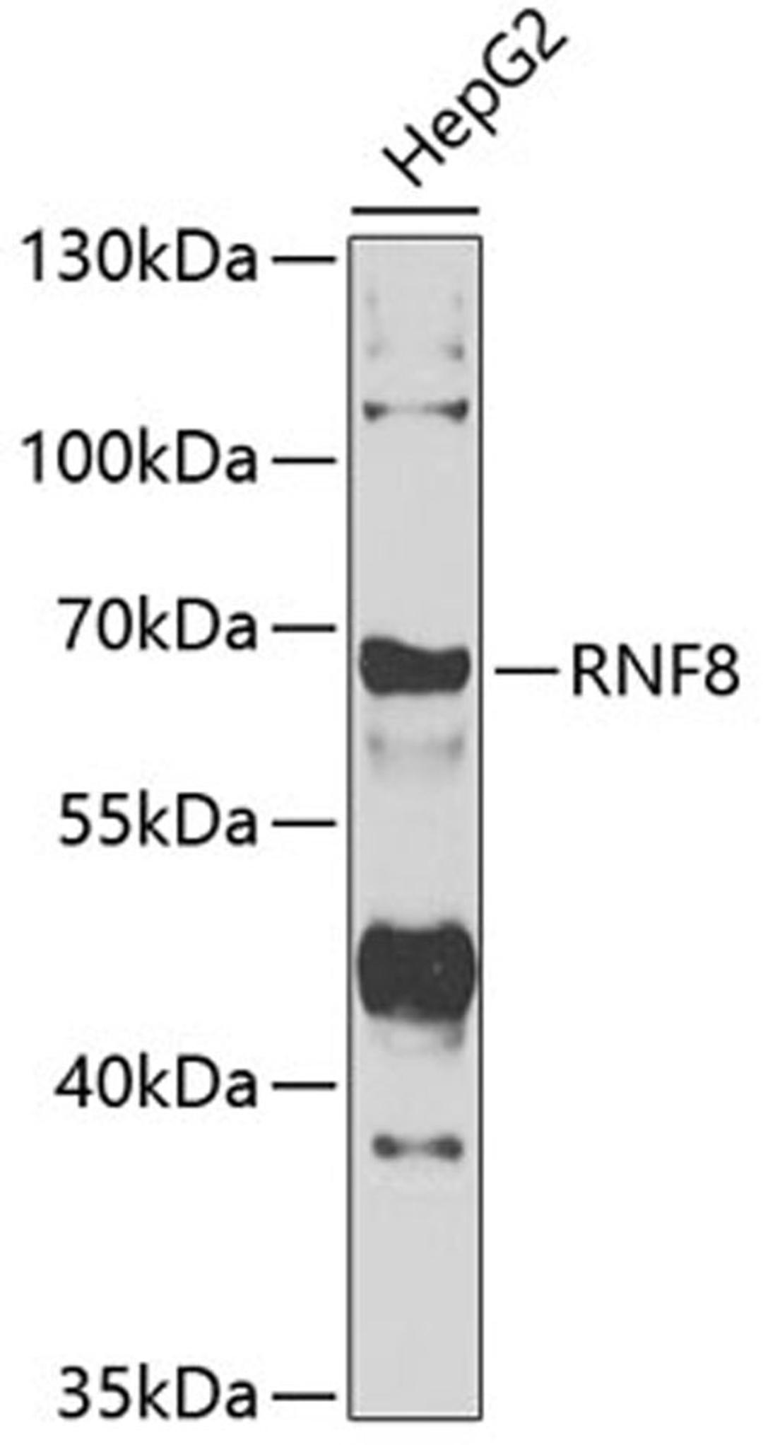 Western blot - RNF8 antibody (A7302)