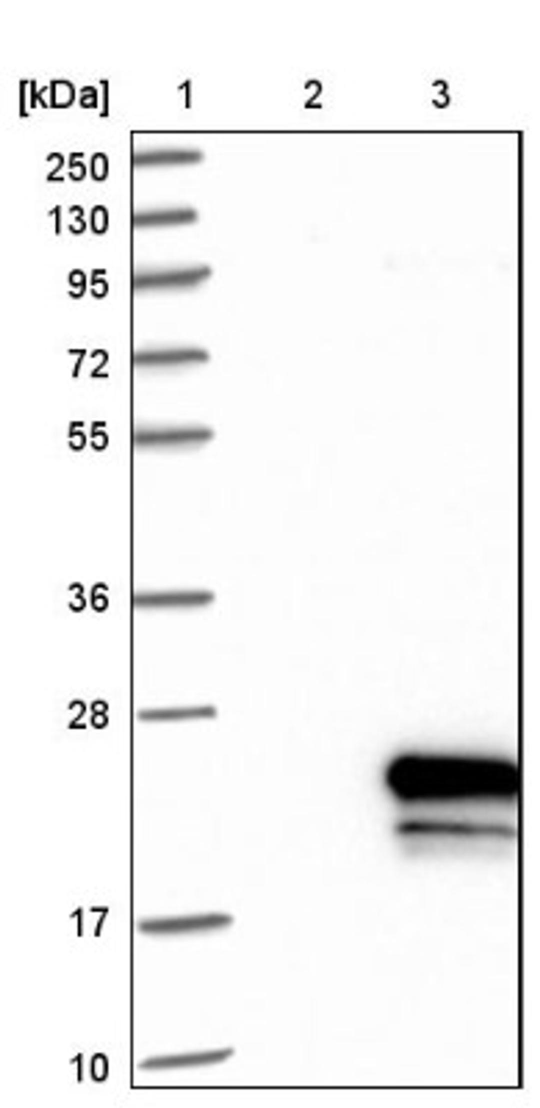 Immunohistochemistry: OSTB Antibody [NBP1-91108] - Lane 1: Marker [kDa] 250, 130, 95, 72, 55, 36, 28, 17, 10<br/>Lane 2: Negative control (vector only transfected HEK293T lysate)<br/>Lane 3: Over-expression lysate (Co-expressed with a C-terminal myc-DDK tag (~3.1 kDa) in mammalian HEK293T cells, LY405823)