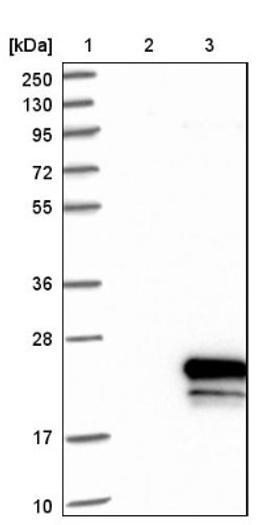 Immunohistochemistry: OSTB Antibody [NBP1-91108] - Lane 1: Marker [kDa] 250, 130, 95, 72, 55, 36, 28, 17, 10<br/>Lane 2: Negative control (vector only transfected HEK293T lysate)<br/>Lane 3: Over-expression lysate (Co-expressed with a C-terminal myc-DDK tag (~3.1 kDa) in mammalian HEK293T cells, LY405823)