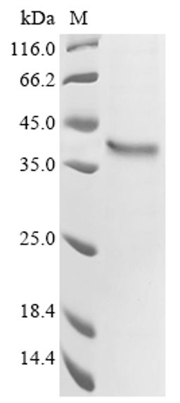 (Tris-Glycine gel) Discontinuous SDS-PAGE (reduced) with 5% enrichment gel and 15% separation gel.