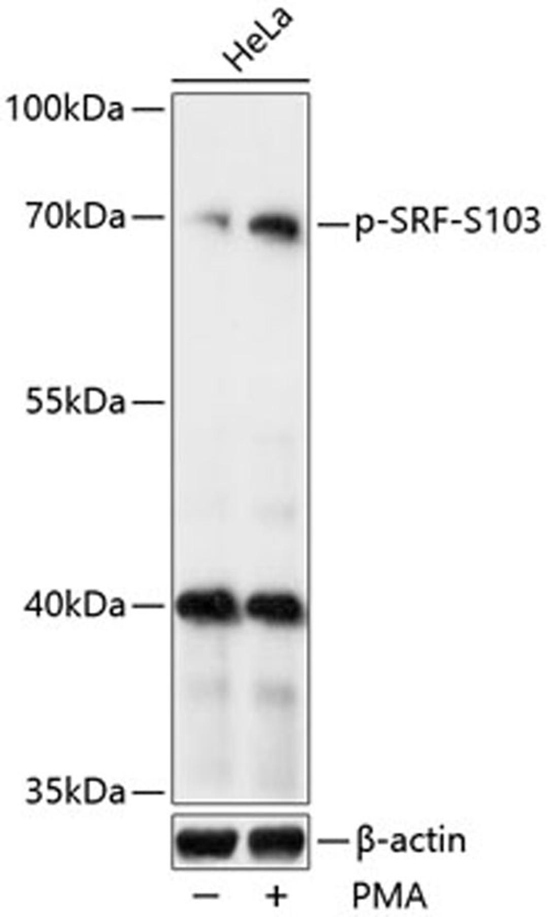 Western blot - Phospho-SRF-S103 antibody (AP0829)