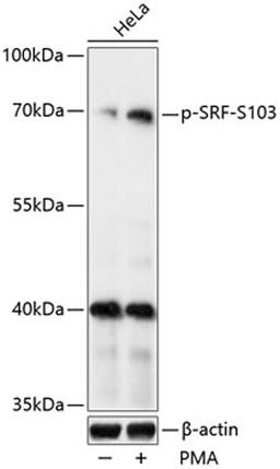 Western blot - Phospho-SRF-S103 antibody (AP0829)