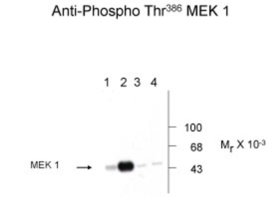 Western blot of human T47D cells showing phospho-specific immunolabeling of the ~45k MEK1 protein phosphorylated at Thr386.