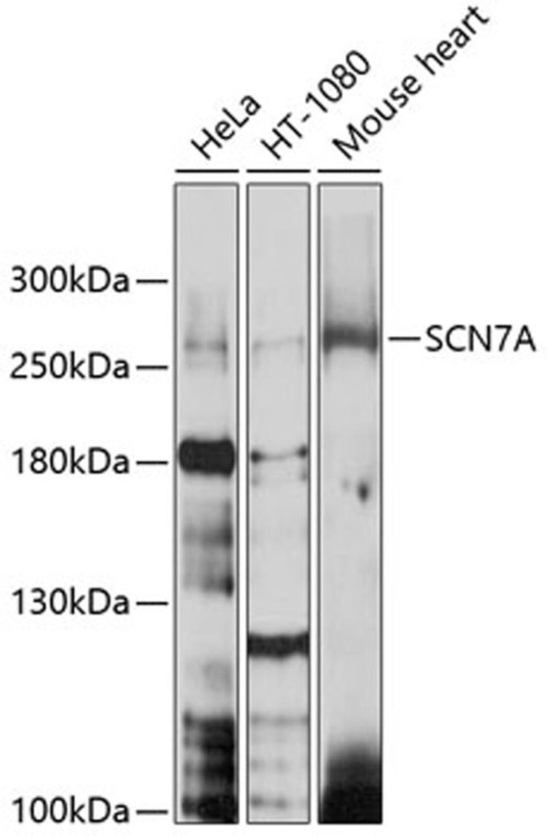 Western blot - SCN7A antibody (A10088)