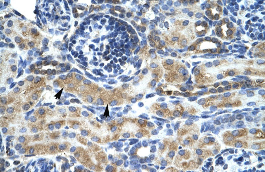 Antibody used in IHC on Human kidney.