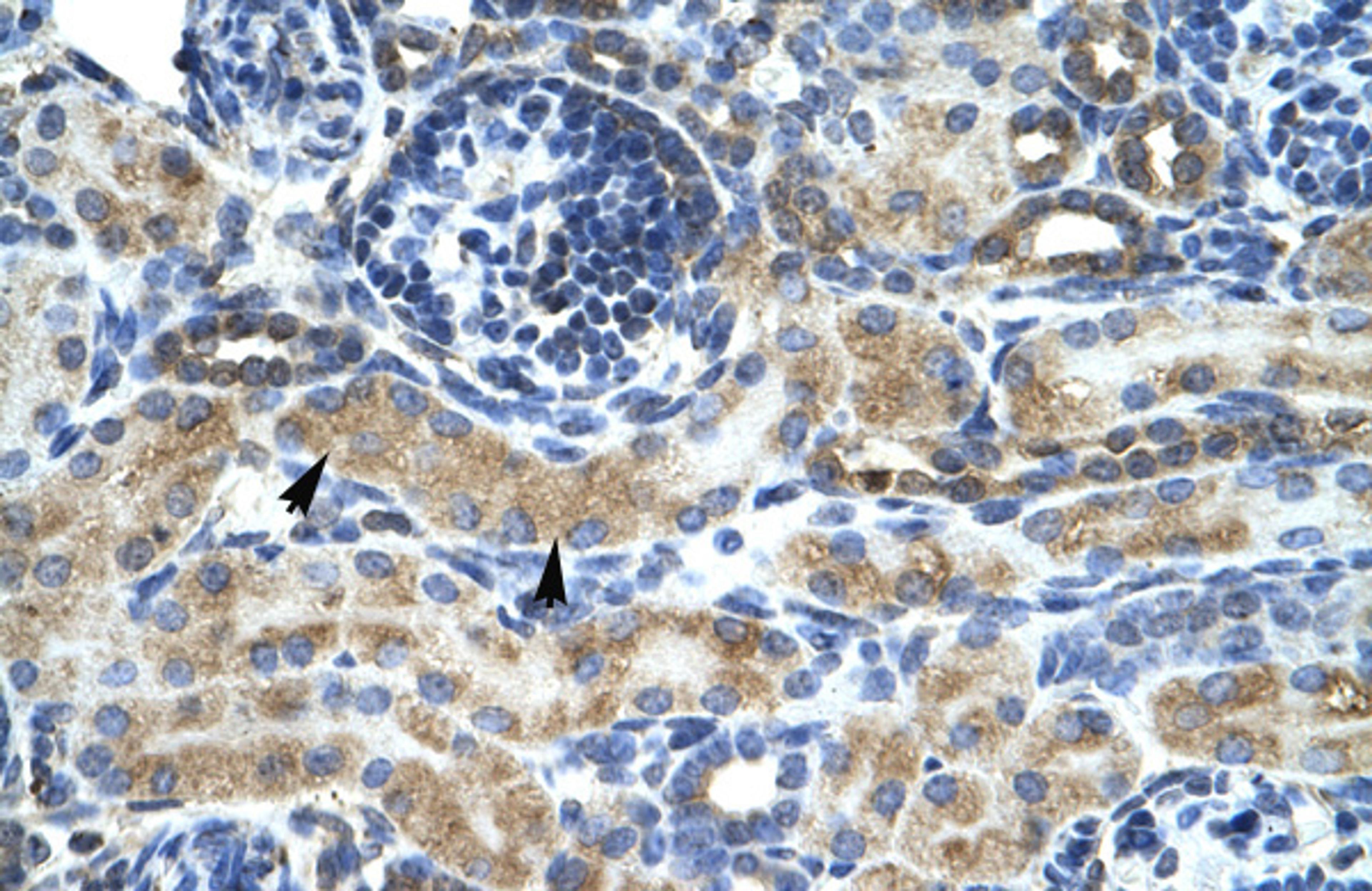 Antibody used in IHC on Human kidney.