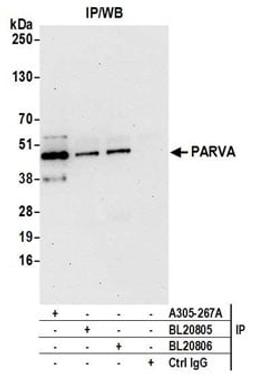 Detection of human PARVA by western blot of immunoprecipitates.