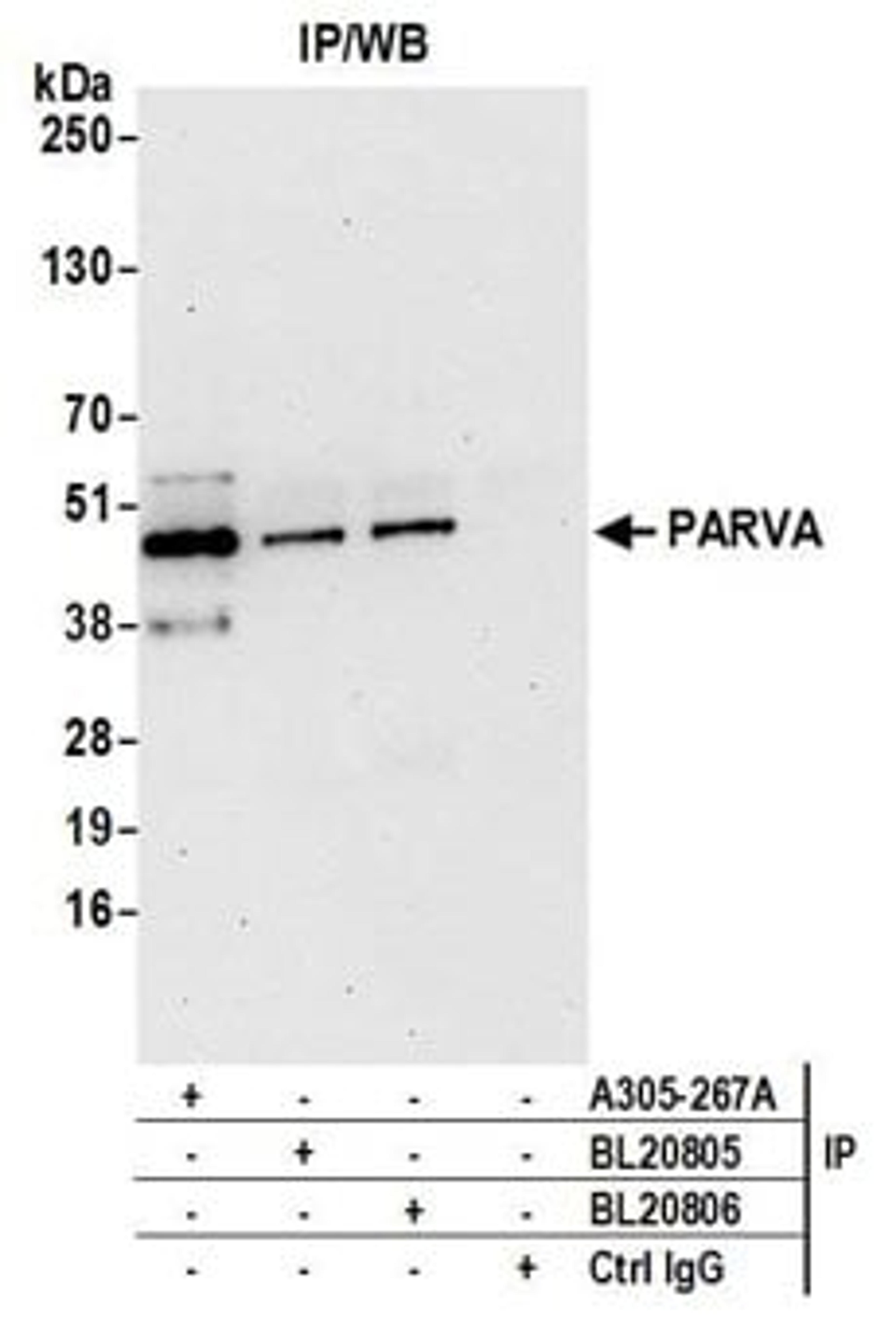 Detection of human PARVA by western blot of immunoprecipitates.