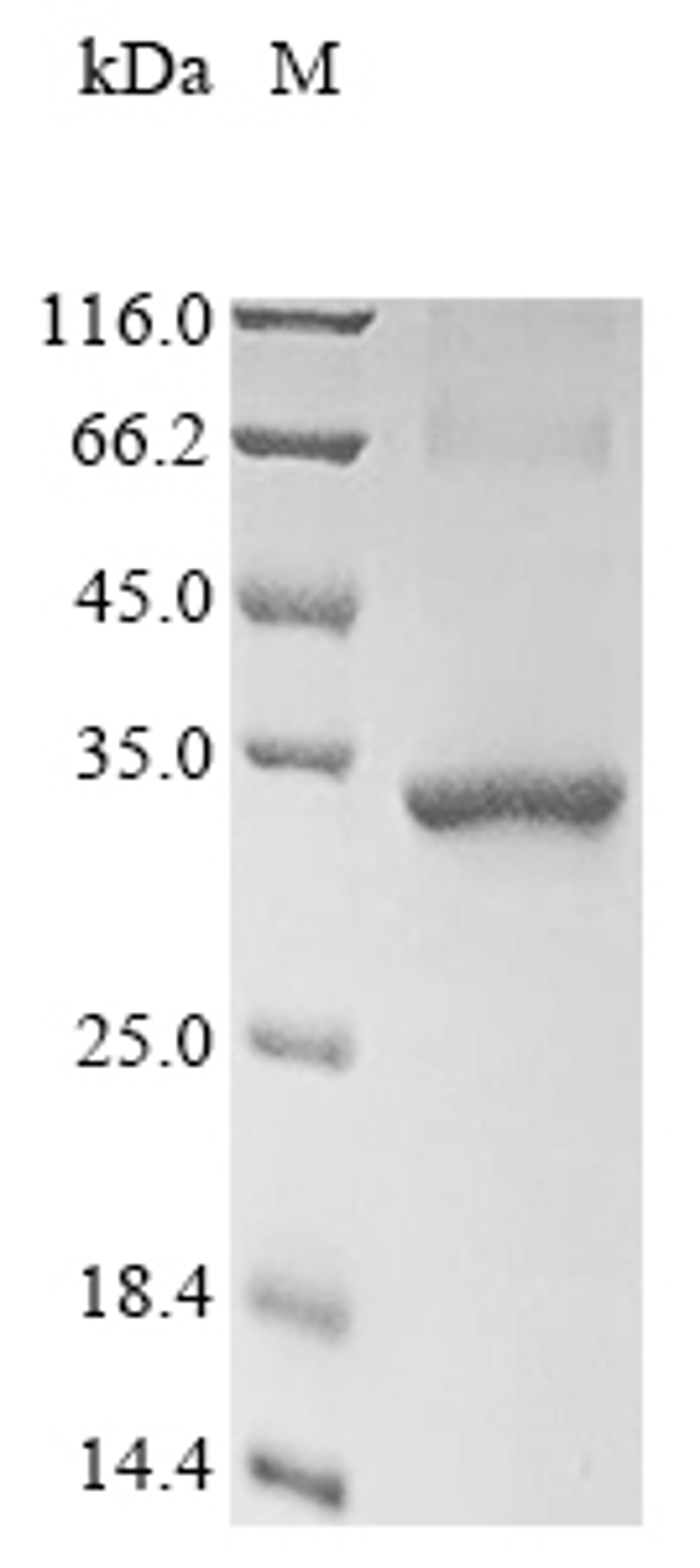 (Tris-Glycine gel) Discontinuous SDS-PAGE (reduced) with 5% enrichment gel and 15% separation gel.