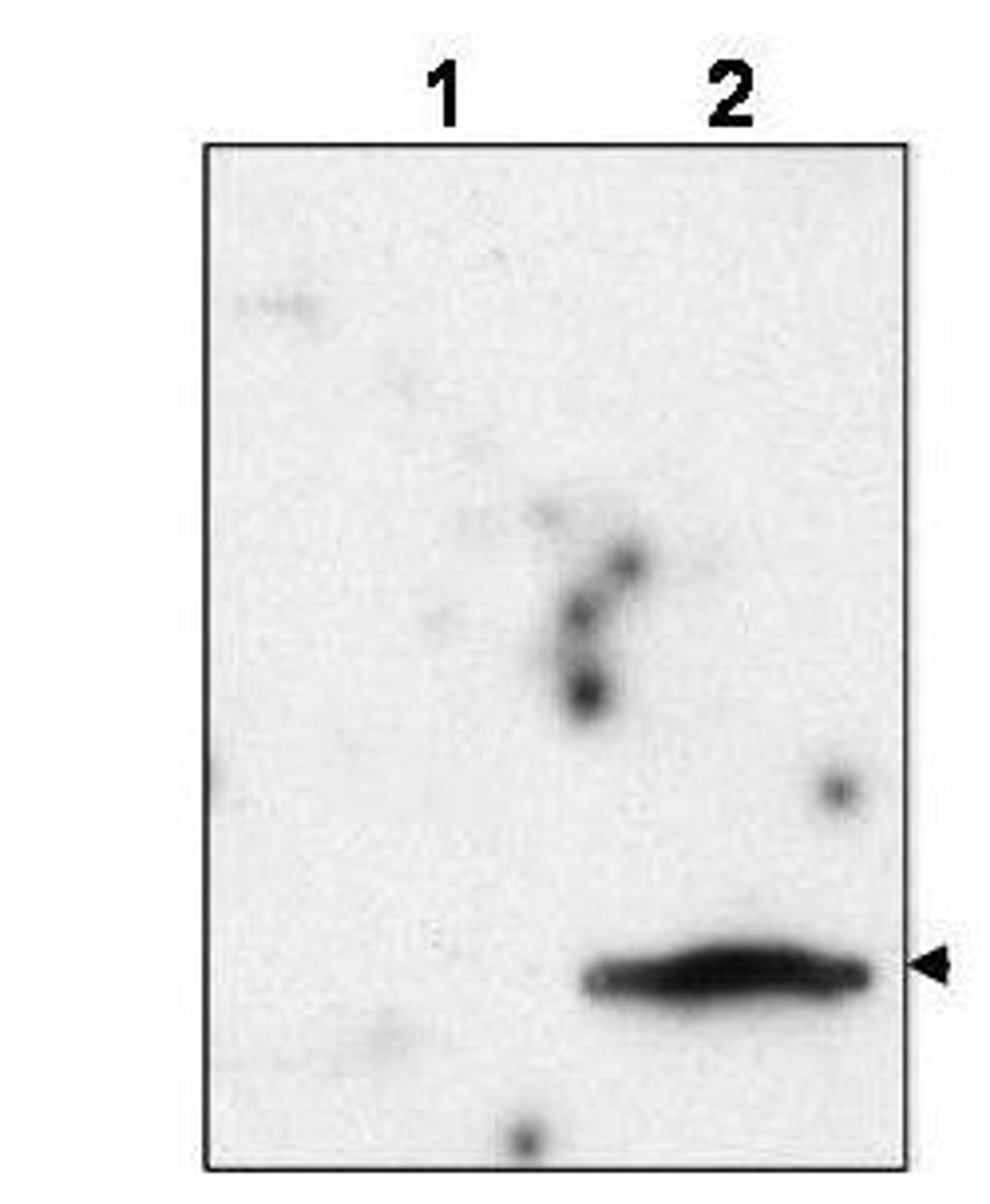 Western blot analysis of FIV-infected feline CrFK cells (lane 2, arrowhead). Lane 1 is an uninfected control using FIV matrix protein p15 antibody