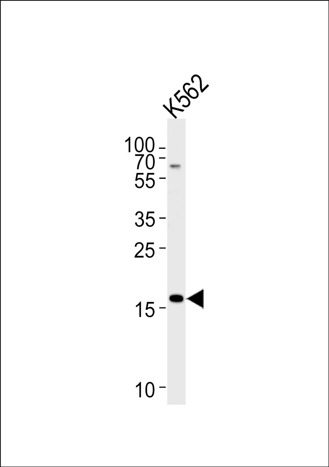 Western blot analysis of lysate from K562 cell line, using RNF5 Antibody at 1:1000 at each lane.