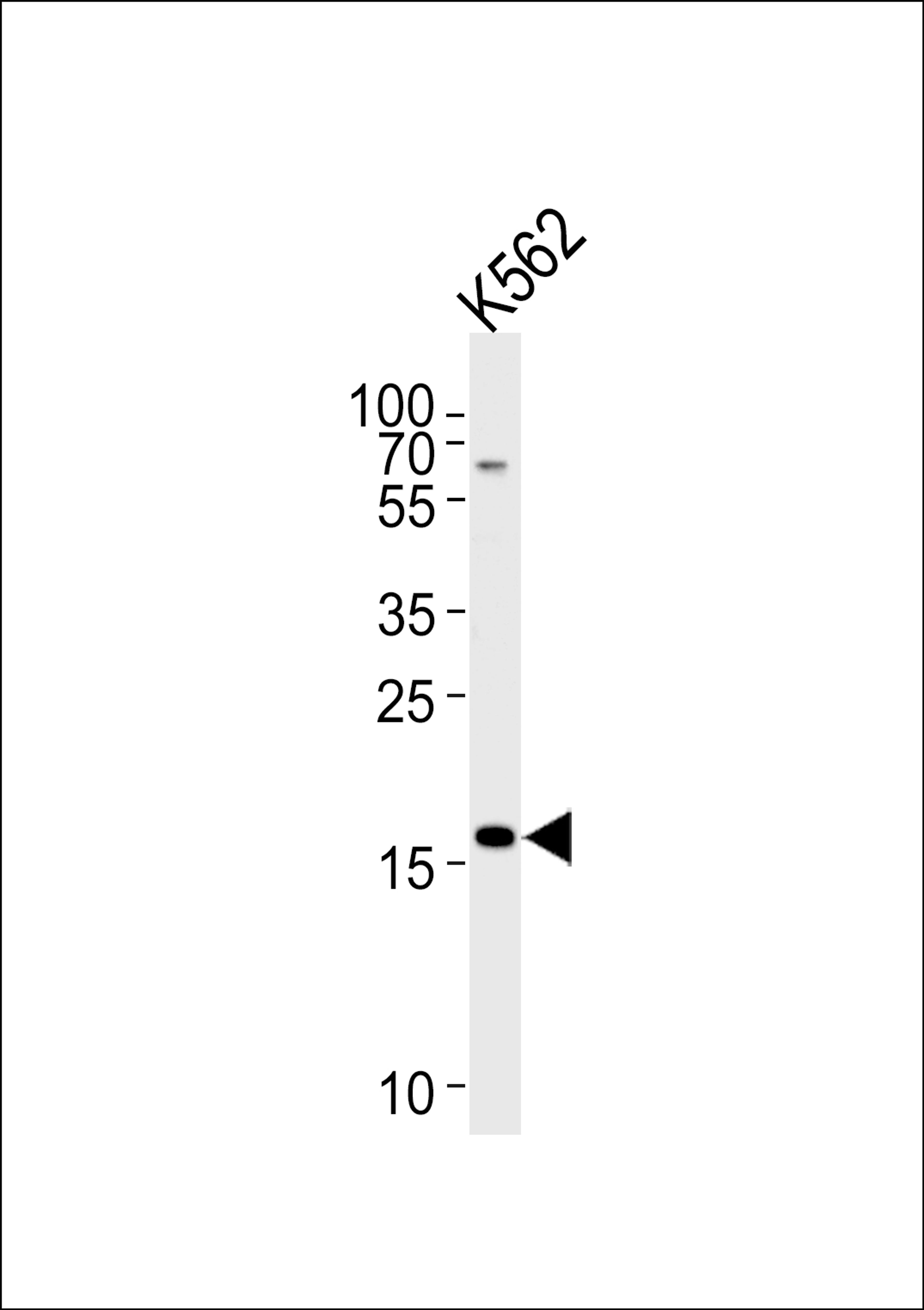 Western blot analysis of lysate from K562 cell line, using RNF5 Antibody at 1:1000 at each lane.