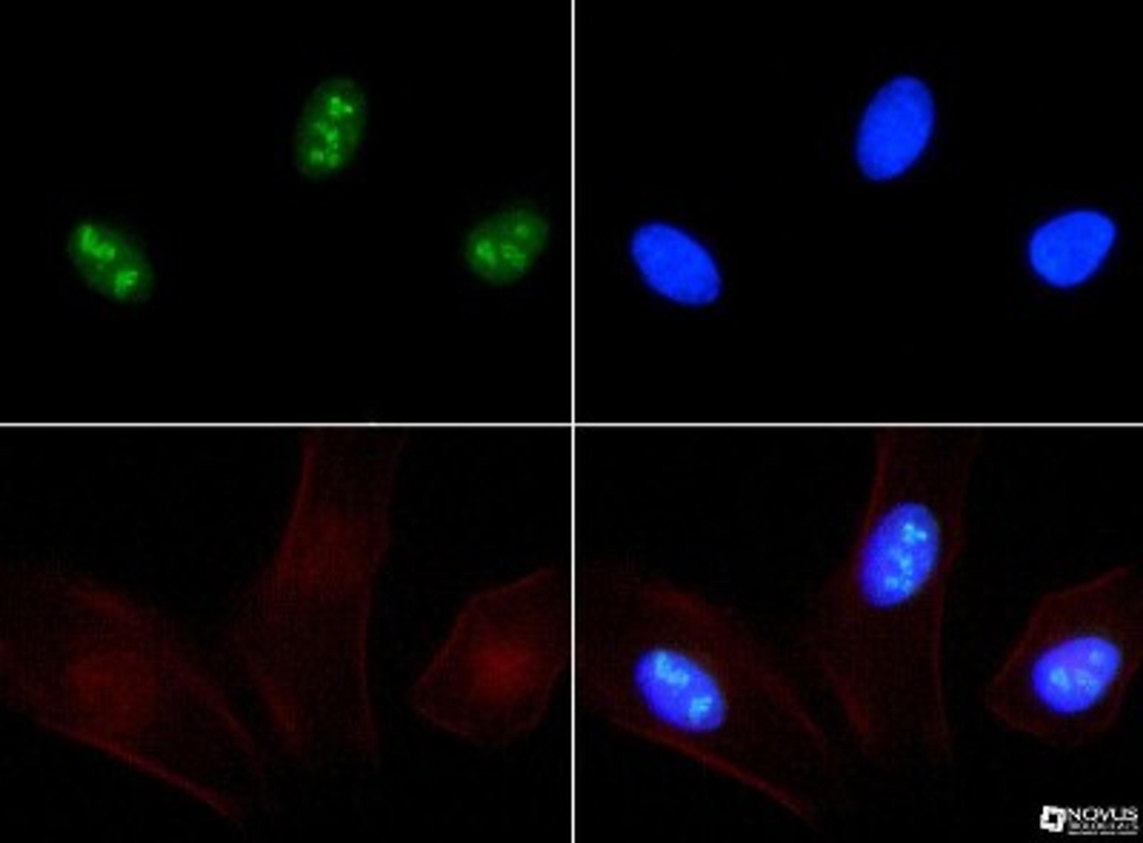 Immunocytochemistry/Immunofluorescence: Ki67 Antibody [NB500-170] - Ki67 antibody was tested at 1:25 in HeLa cells with FITC (green). Nuclei and actin were counterstained with Dapi (blue) and Phalloidin (red).