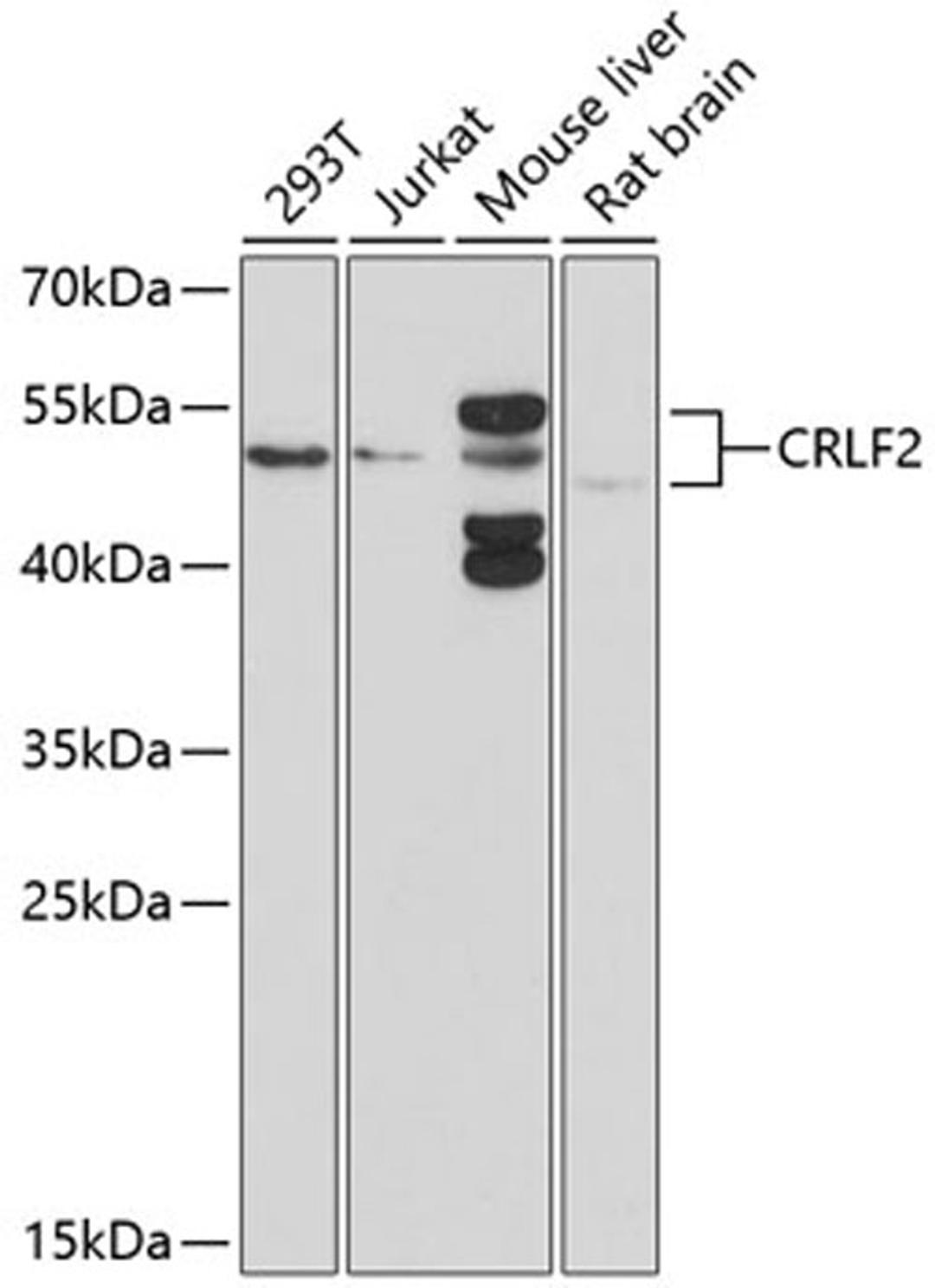 Western blot - CRLF2 antibody (A10152)