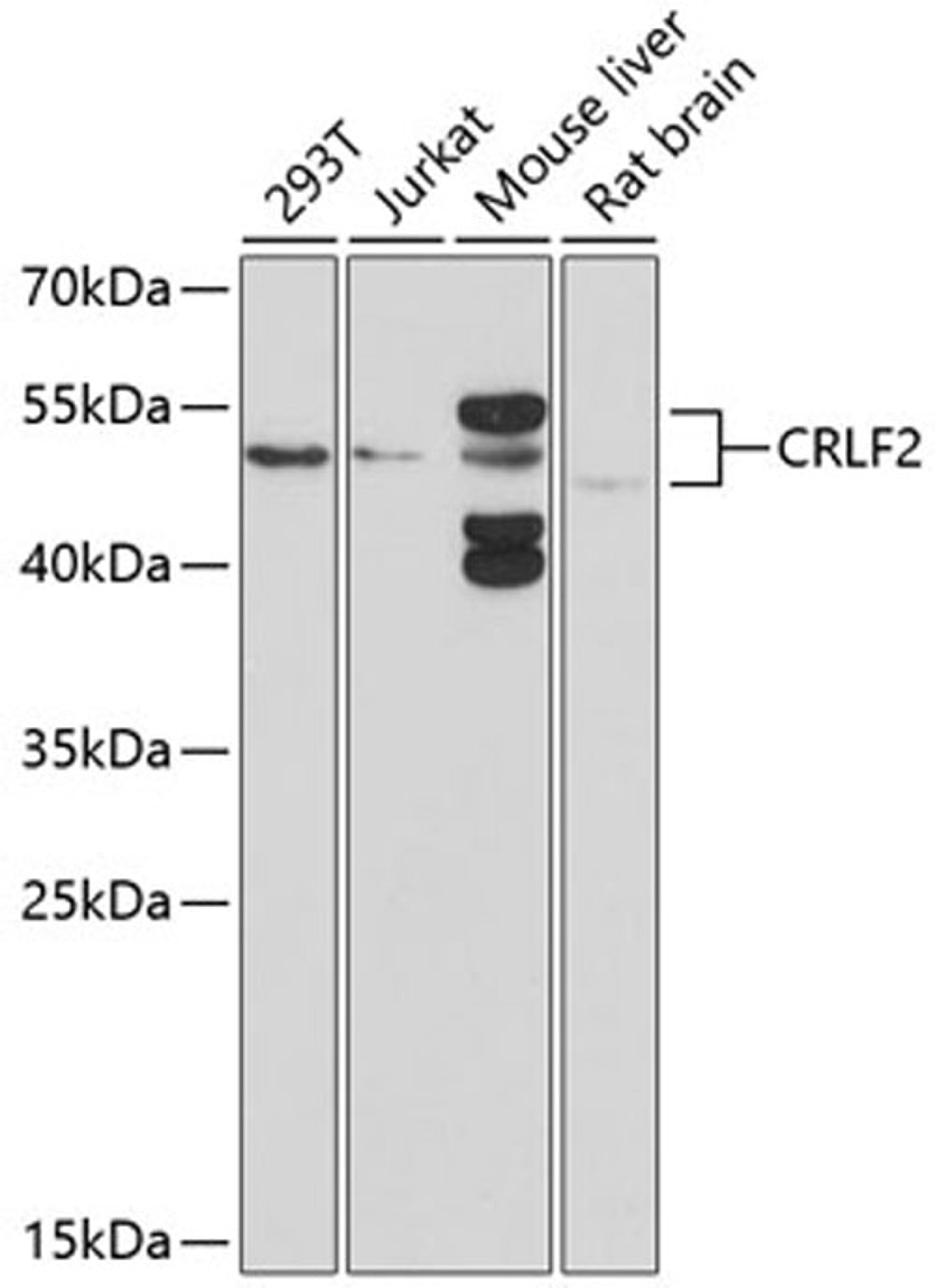 Western blot - CRLF2 antibody (A10152)