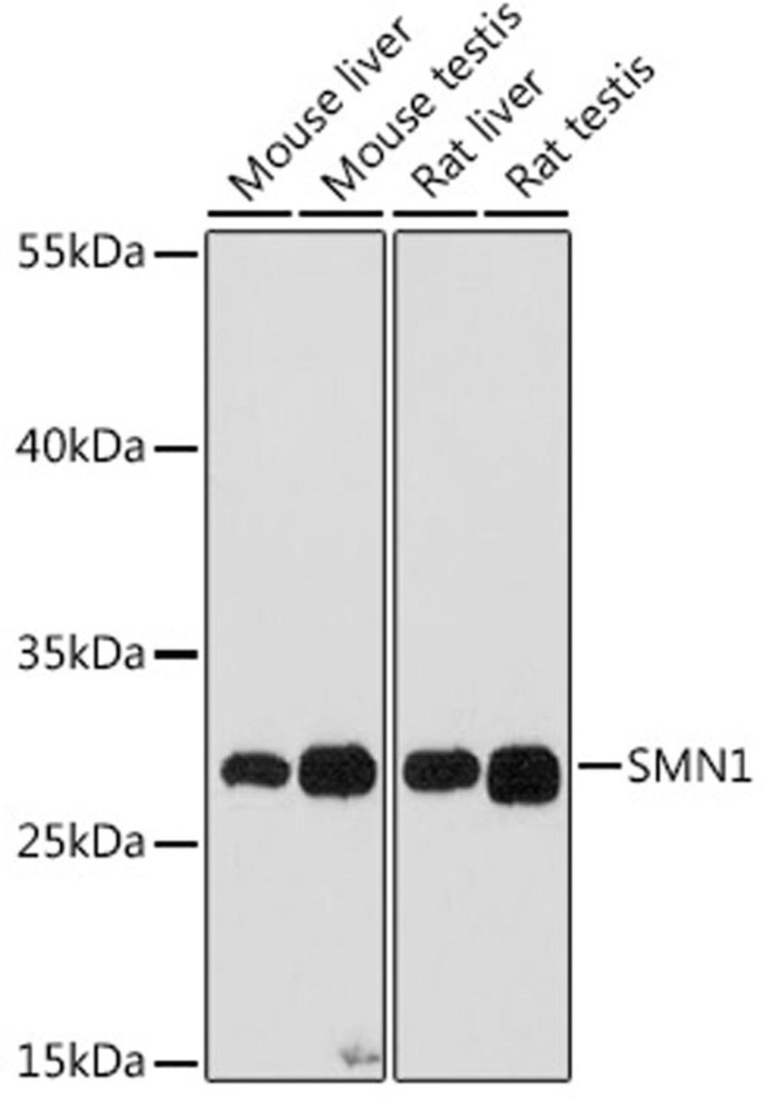 Western blot - SMN1 antibody (A16246)