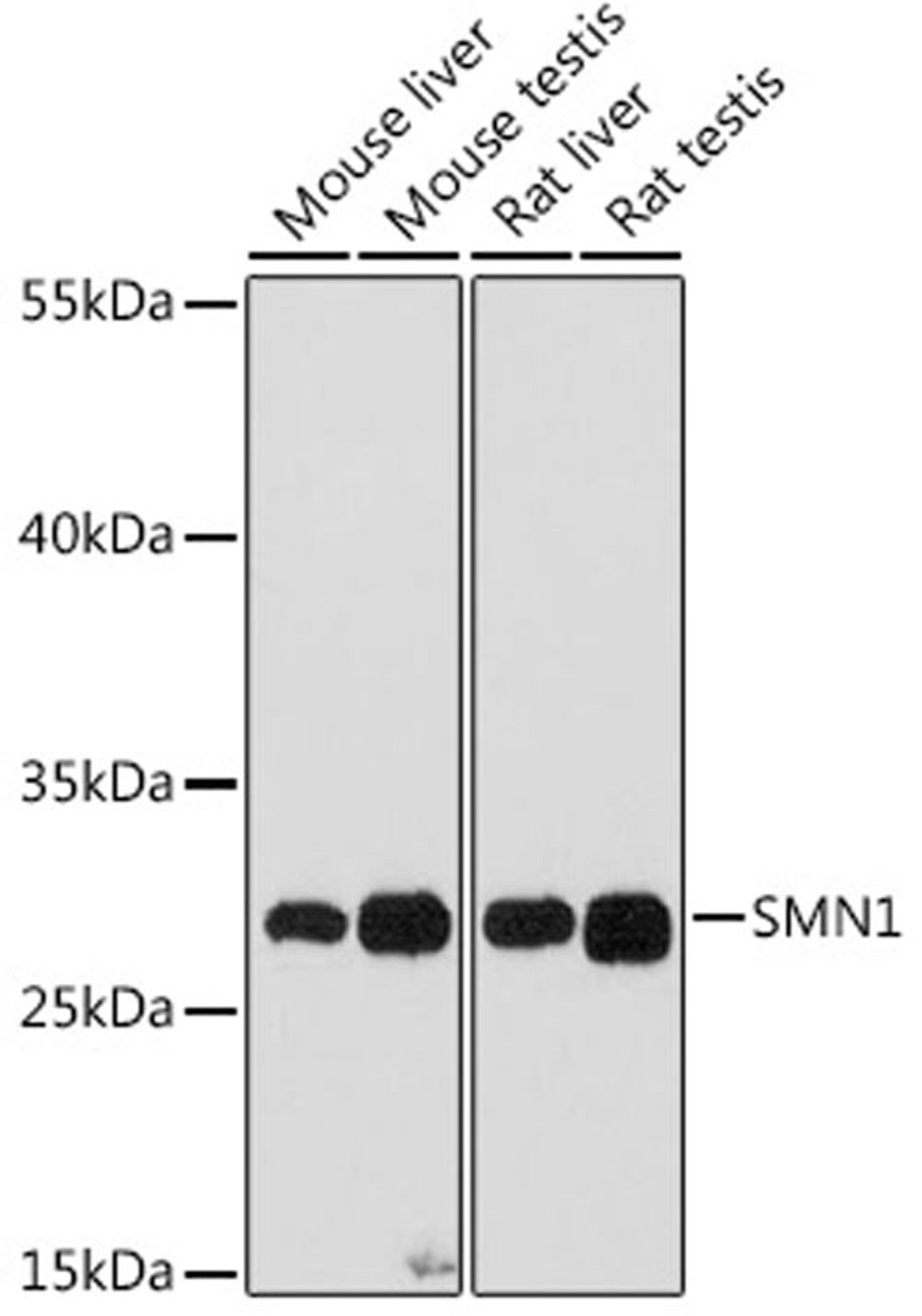 Western blot - SMN1 antibody (A16246)