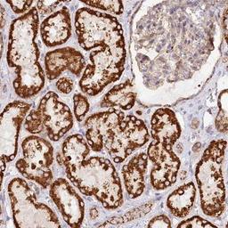 Immunohistochemistry: UMPS Antibody [NBP1-85895] - Staining of human kidney shows strong cytoplasmic positivity, with a granular pattern in cells in tubules.